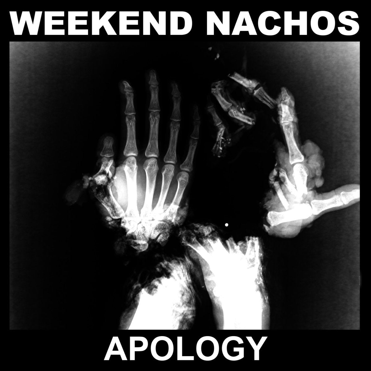 WEEKEND NACHOS - APOLOGY