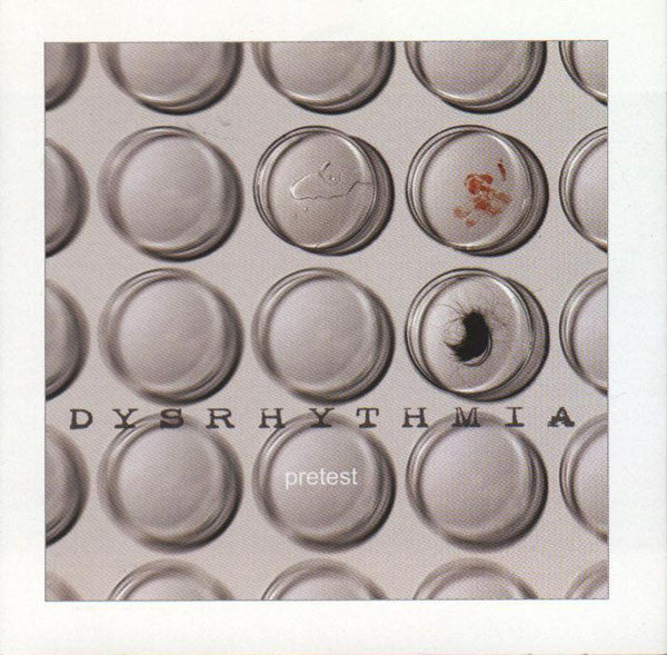DYSRHYTHMIA - PRETEST