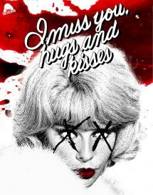 I MISS YOU, HUGS AND KISSES [BLU-RAY]