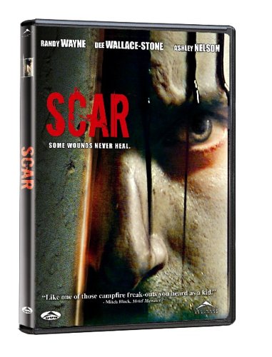 SCAR
