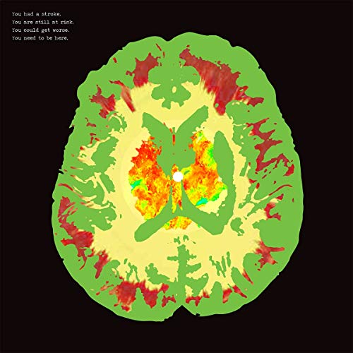 THE MINUS 5 - STROKE MANOR (CD)