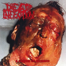 DEAD INFECTION - A CHAPTER OF ACCIDENTS [CD]