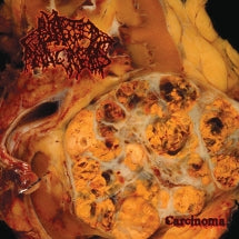 BLASTED PANCREAS - CARCINOMA [CD]